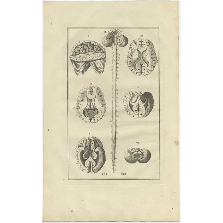 Pl. 17 Antique Anatomy Print of the Brain and Spinal Cord by Elwe (1798)
